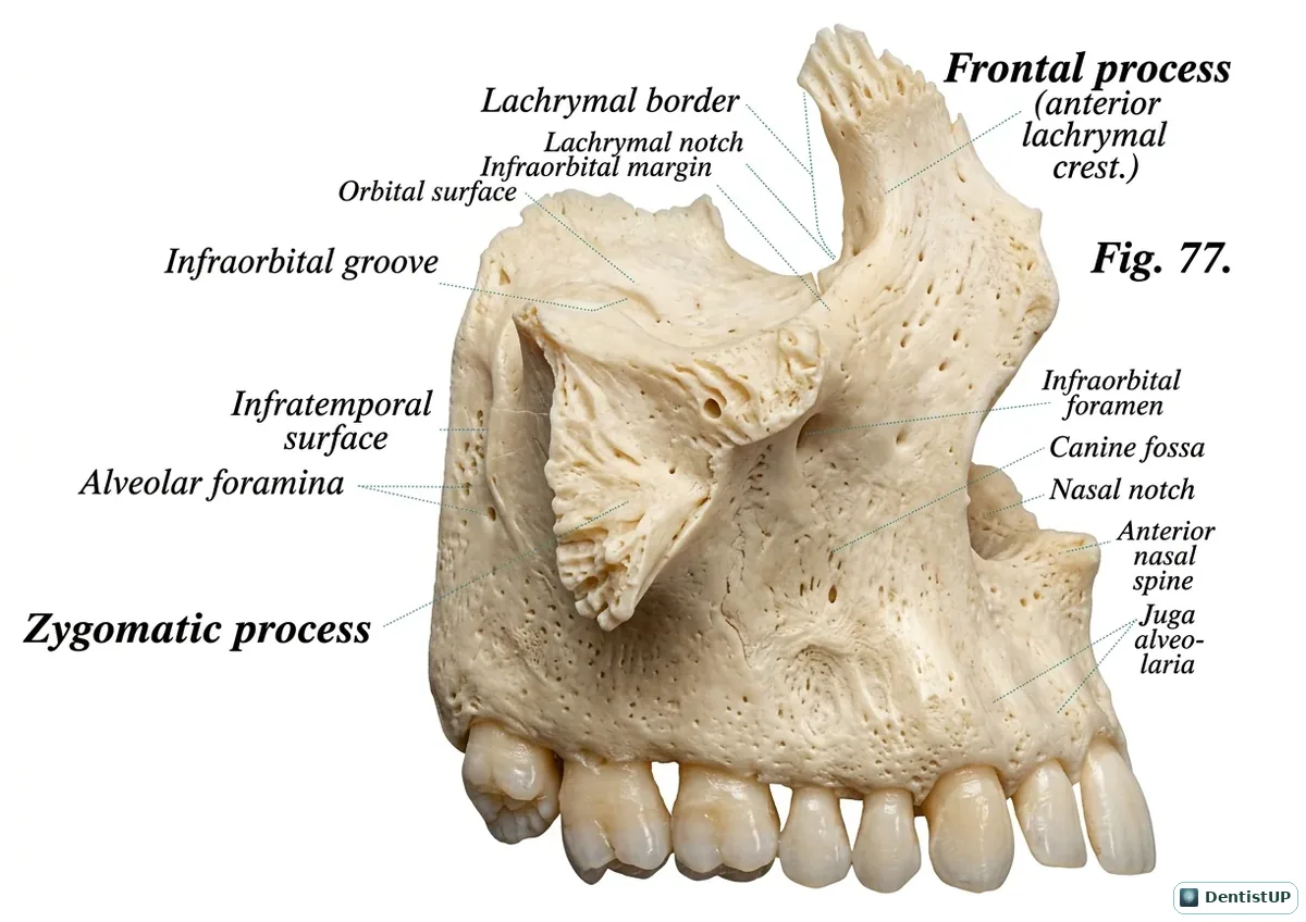 Lateral view of the maxilla with the frontal process, infraorbital foramen and groove, canine fossa, zygomatic process, alveolar foramina and anterior nasal spine labelled